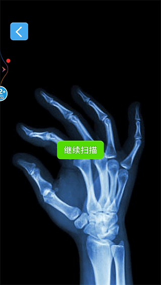 X射线模拟器